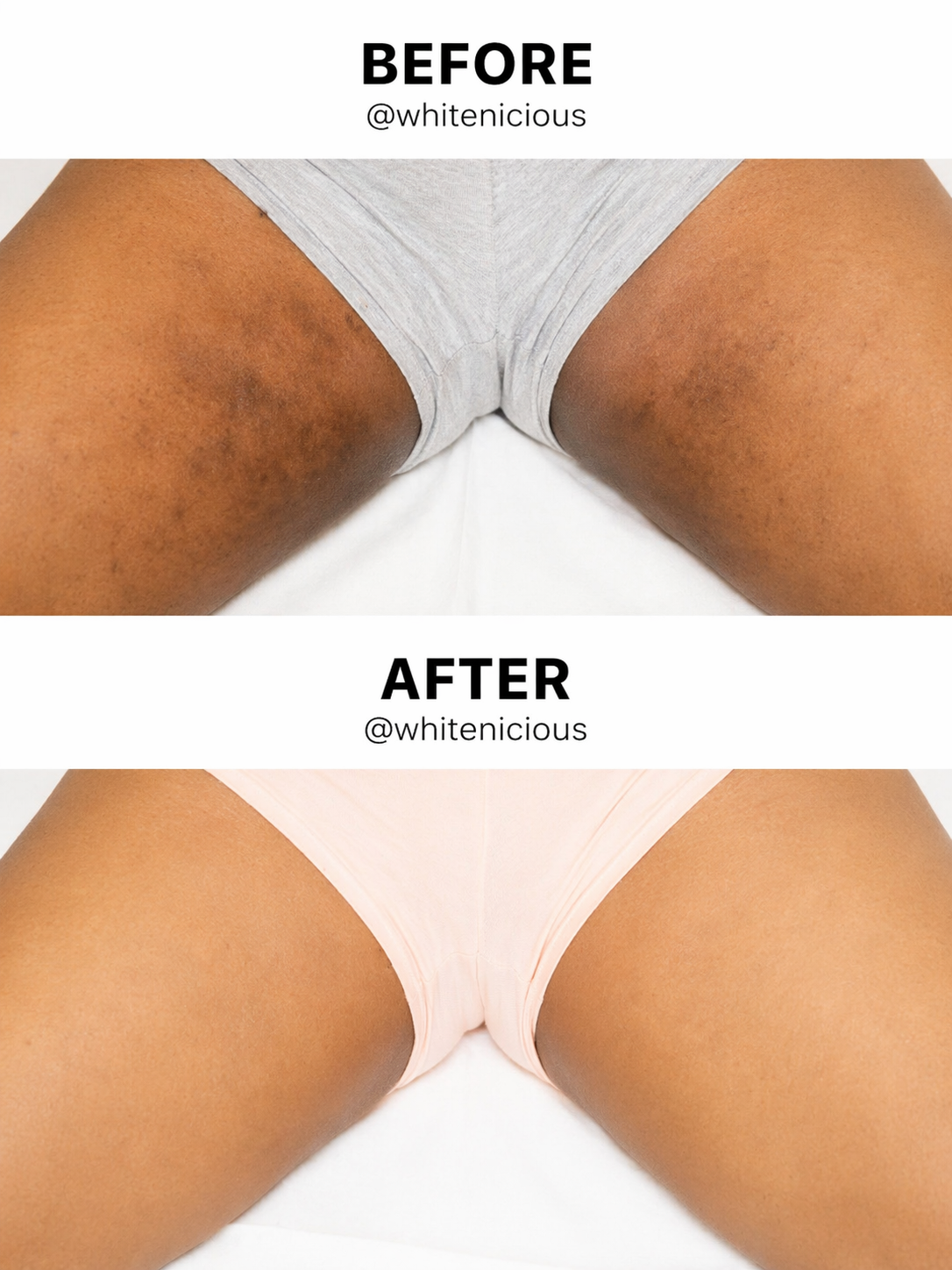 Inner Thigh lightening Cream