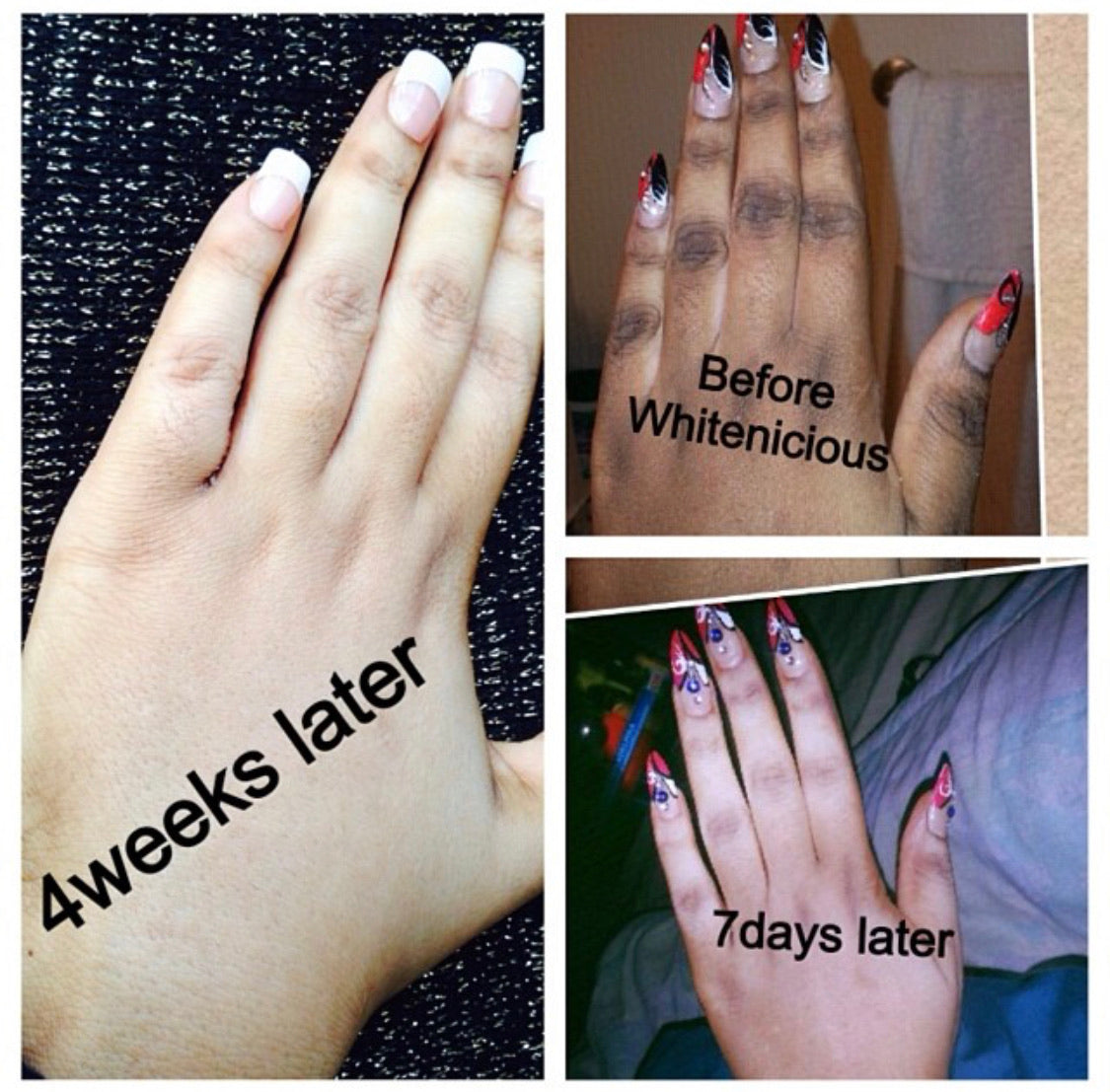 Dark Knuckles,Knees & Elbows Bleaching Cream Set. Blac Chyna