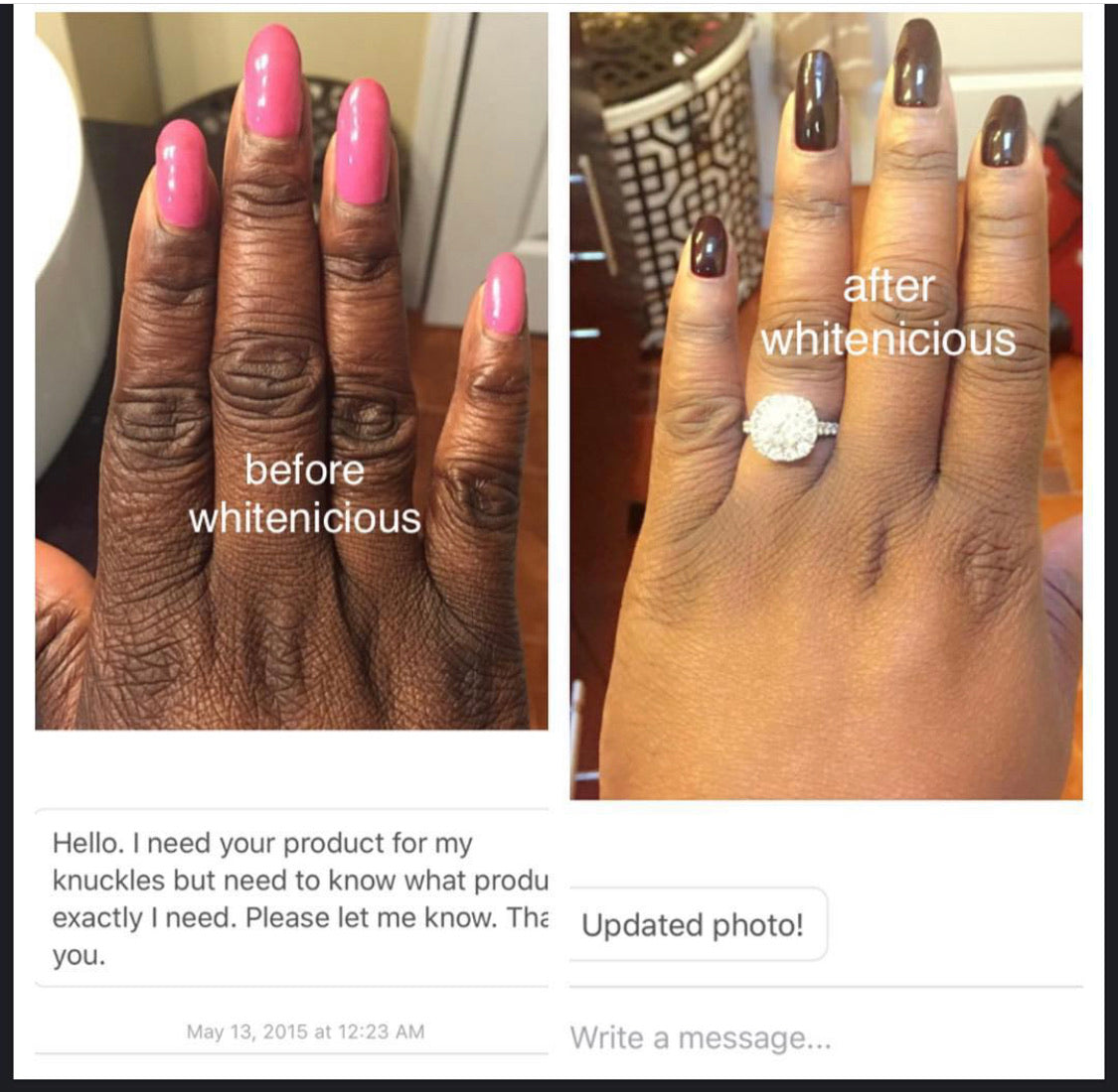 Elbows, Knees, Knuckles Bleaching Cream Blac Chyna