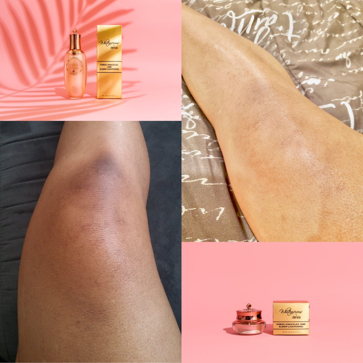 KNUCKLE/ KNEES & ELBOWS PERFECTION