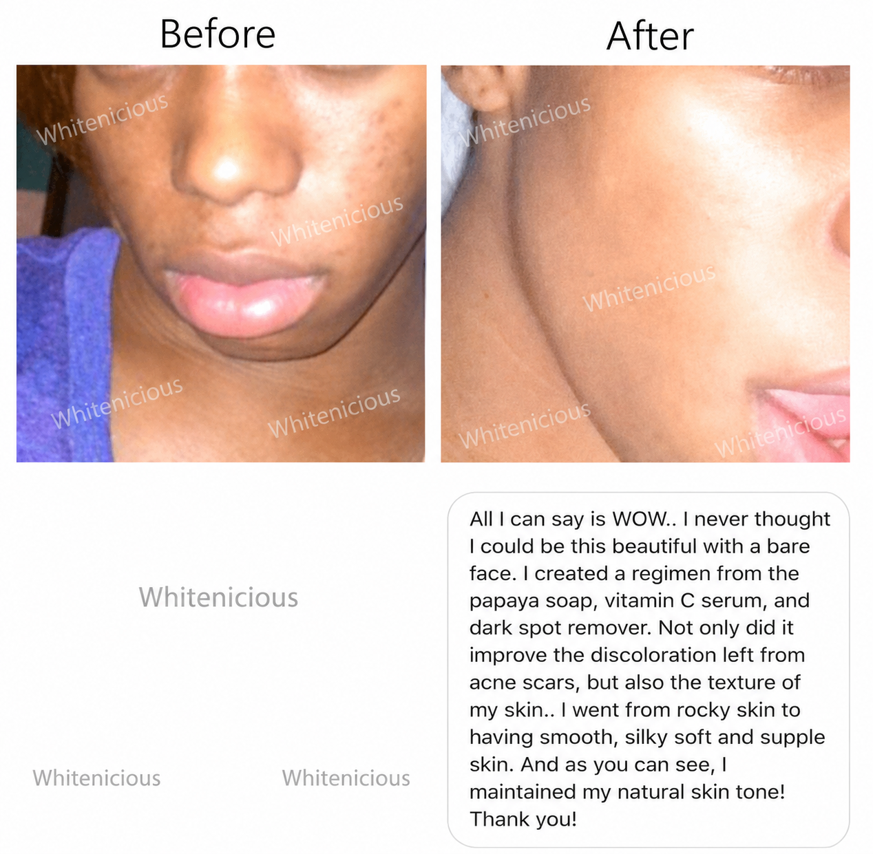 Flewed Out Skin