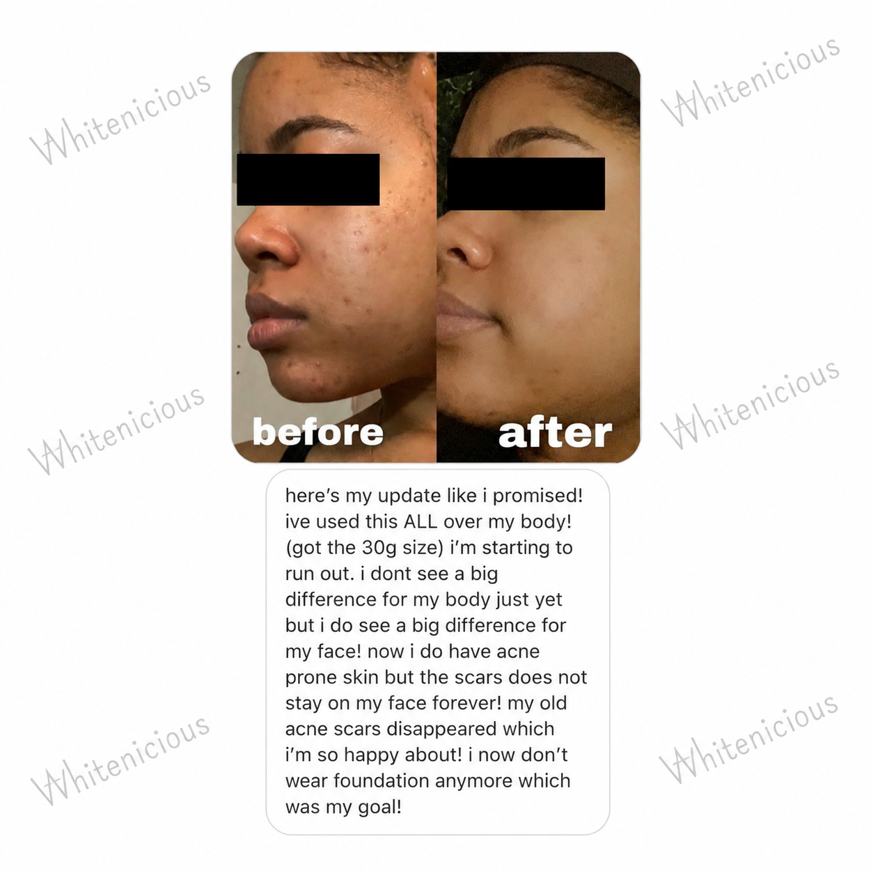 Flewed Out Skin