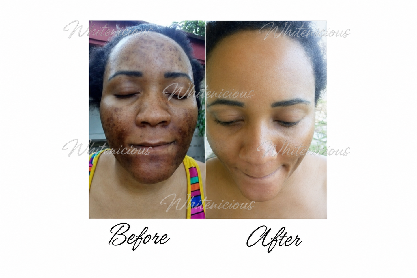 Flewed Out Skin