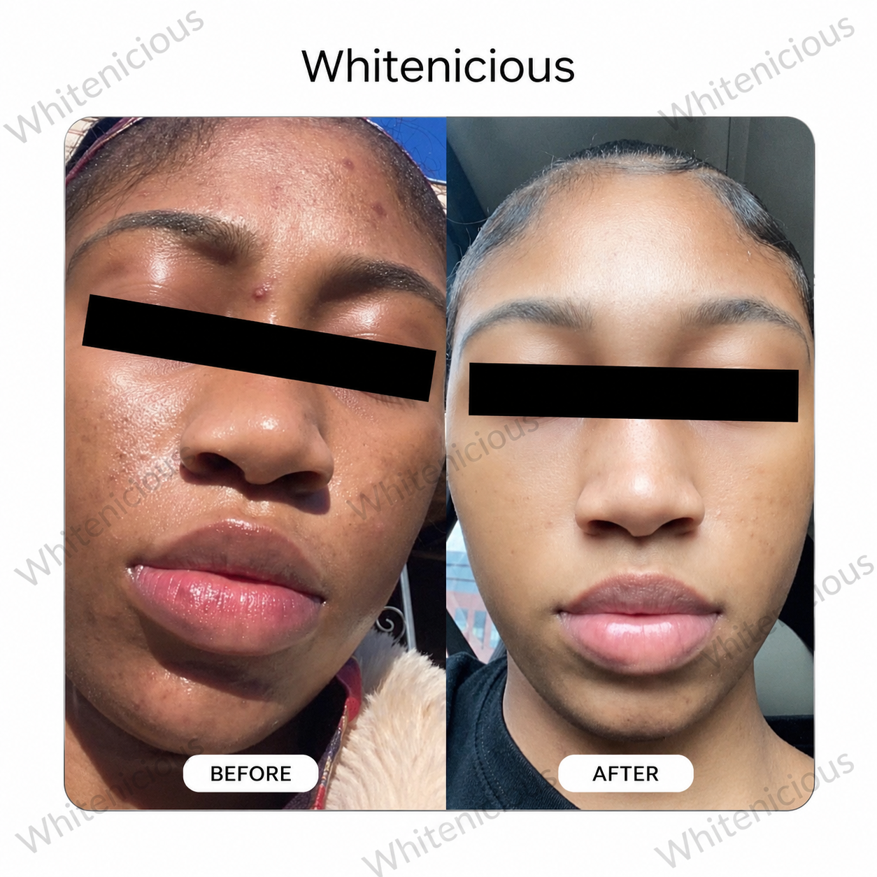 Flewed Out Skin