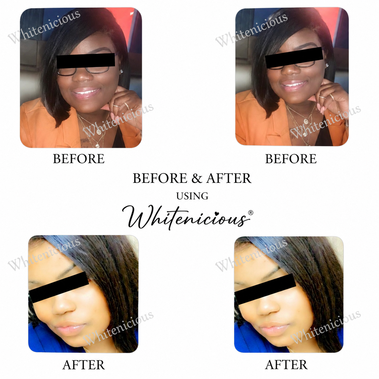Flewed Out Skin