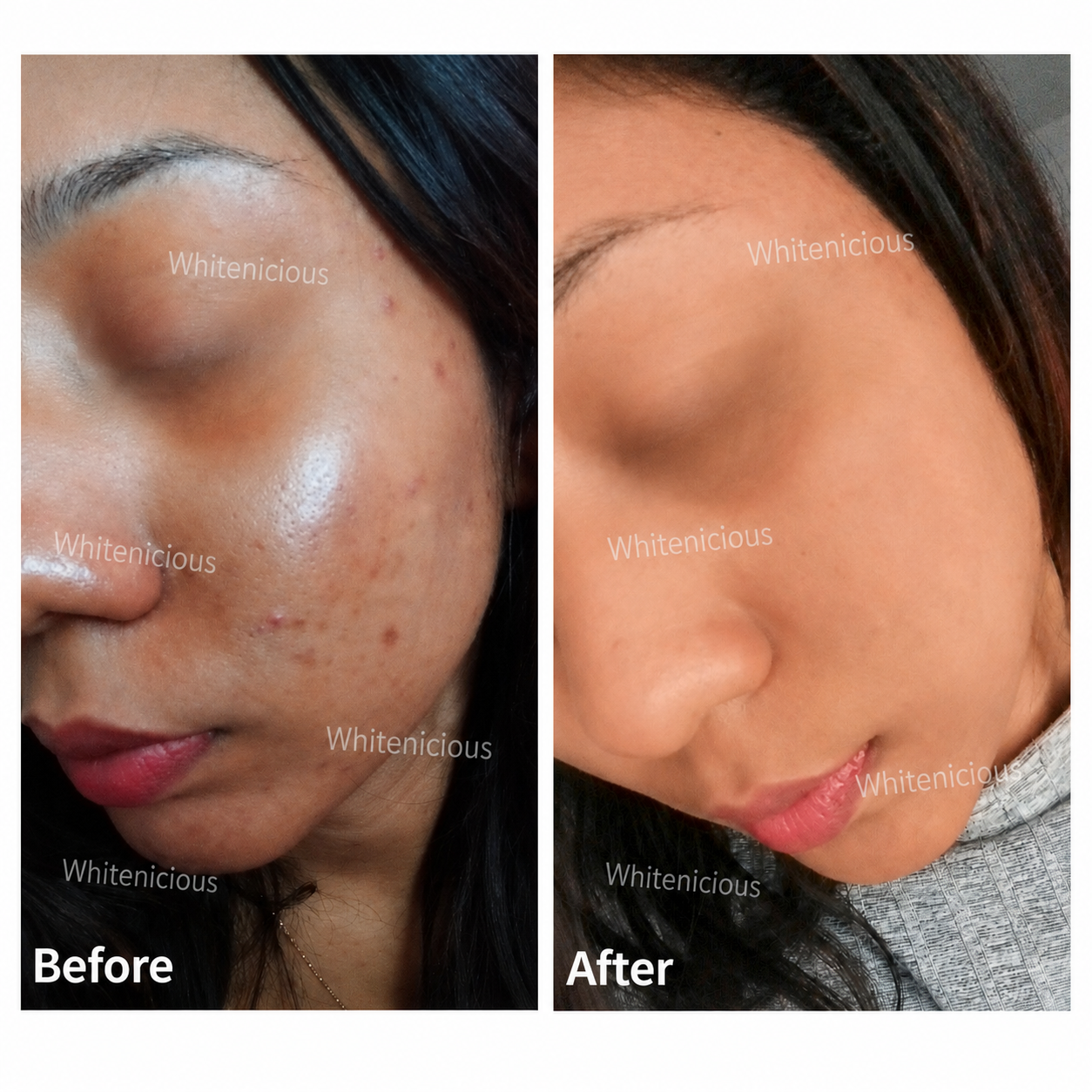 Flewed Out Skin