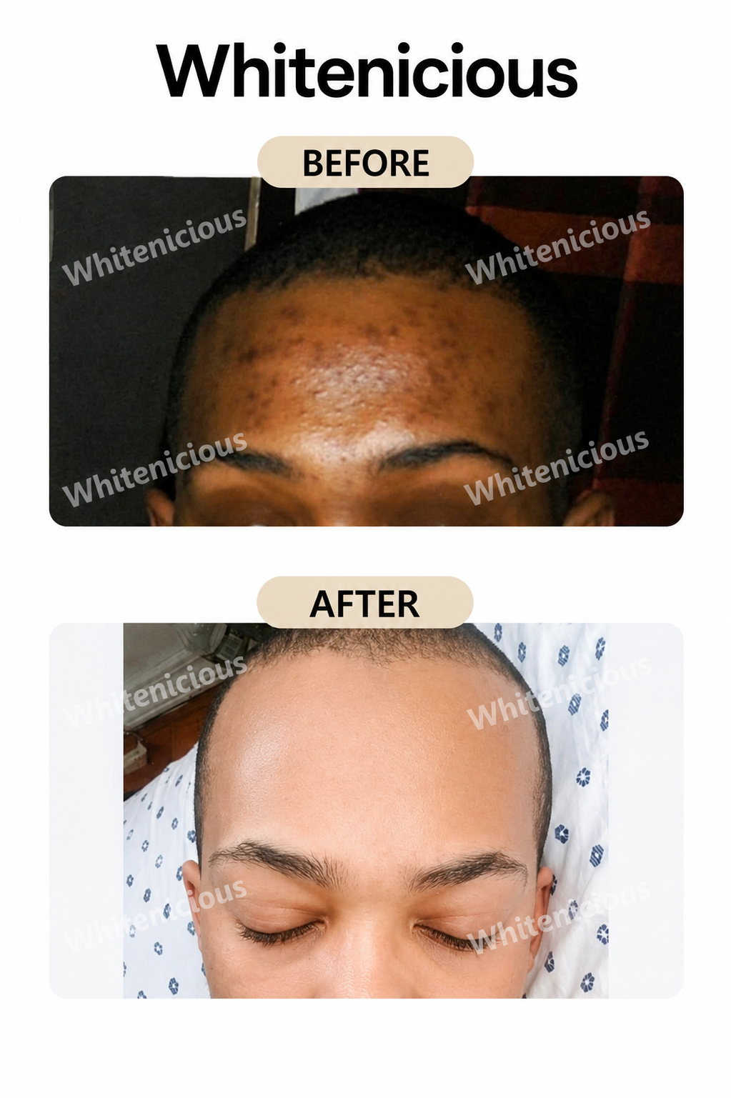 Flewed Out Skin