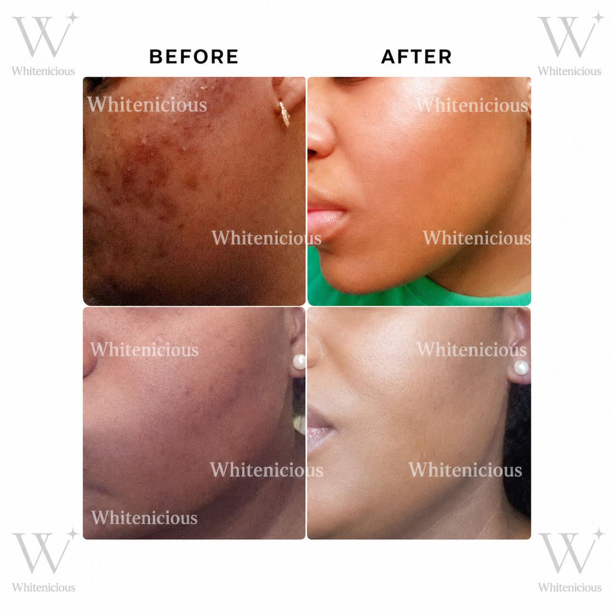 24k Gold Infused DarkSpot  Eraser Crème