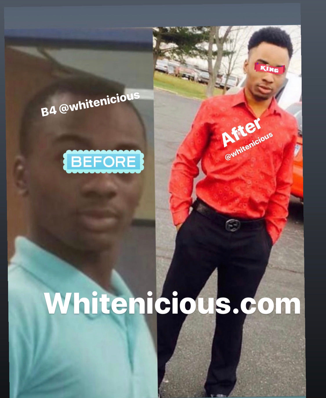 SNOW WHITE FULL BODY SET