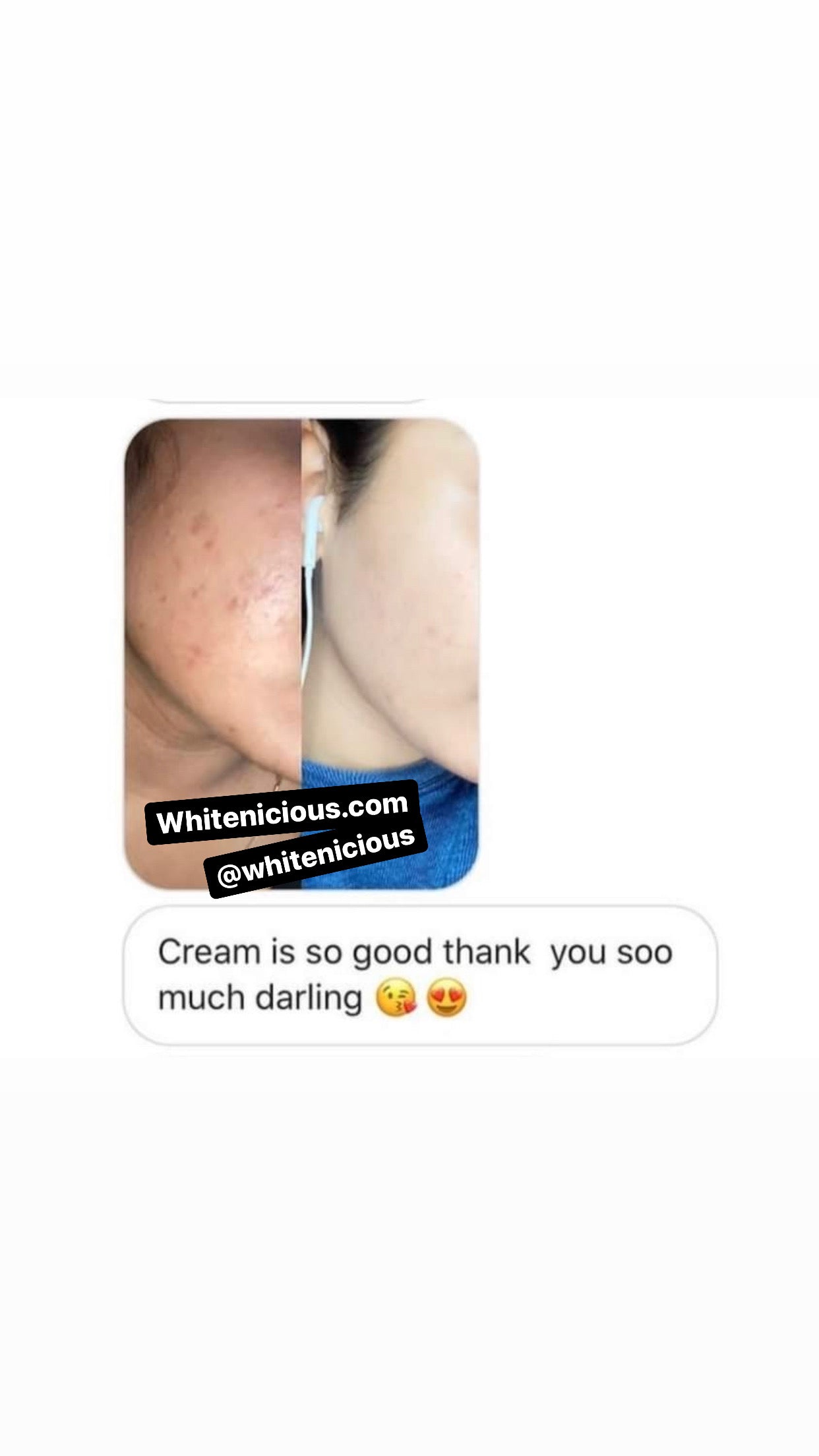 Face Brightening regimen system ( Oily Skin)
