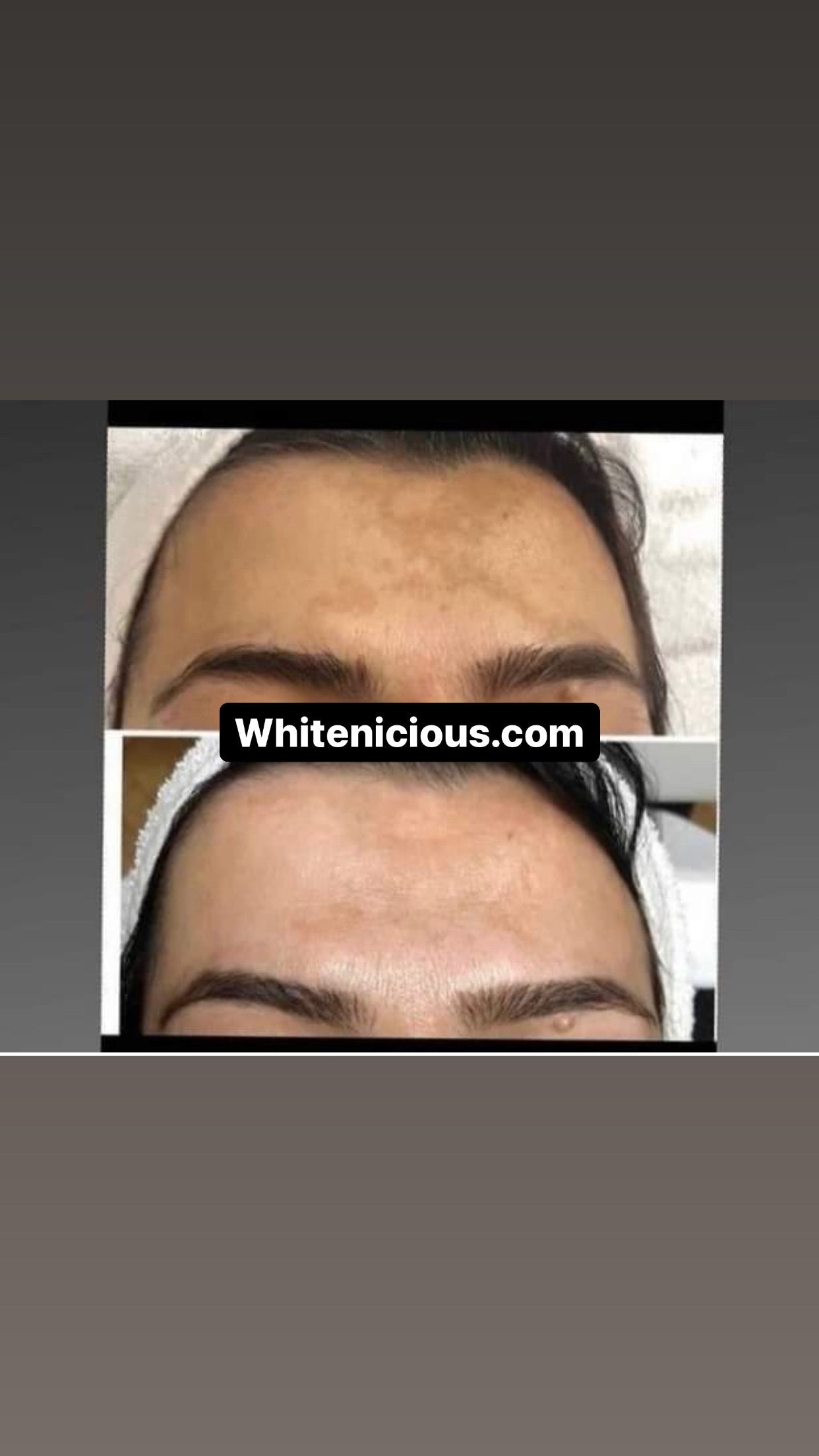Face Brightening regimen system ( Oily Skin)