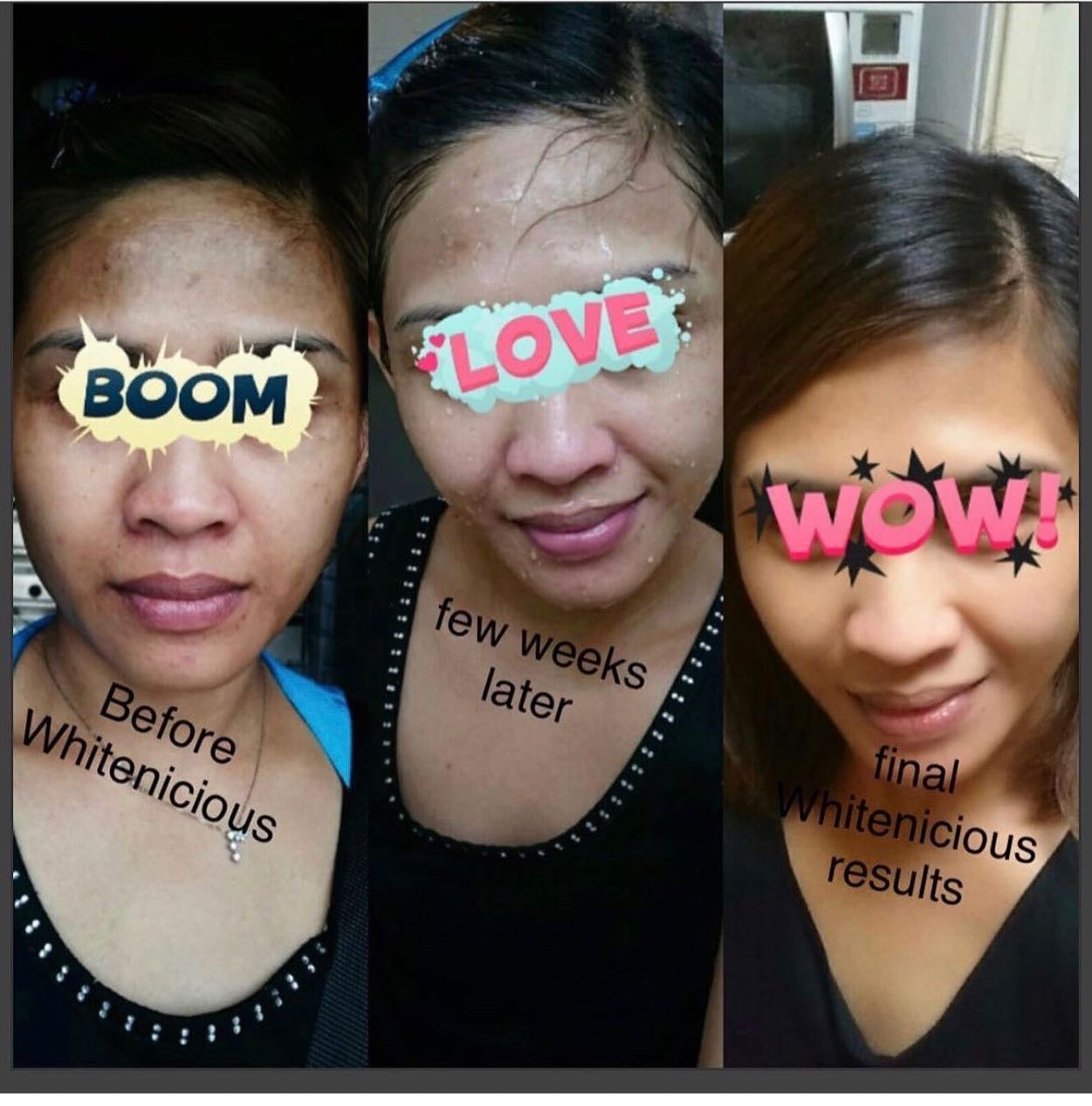 Dark Spot Eraser system