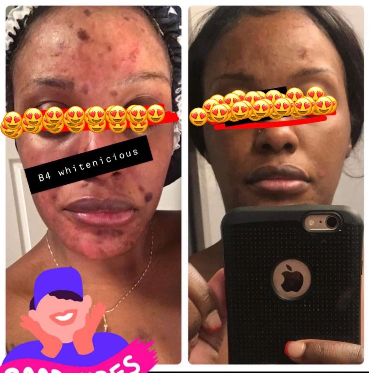 Dark Spot Eraser system