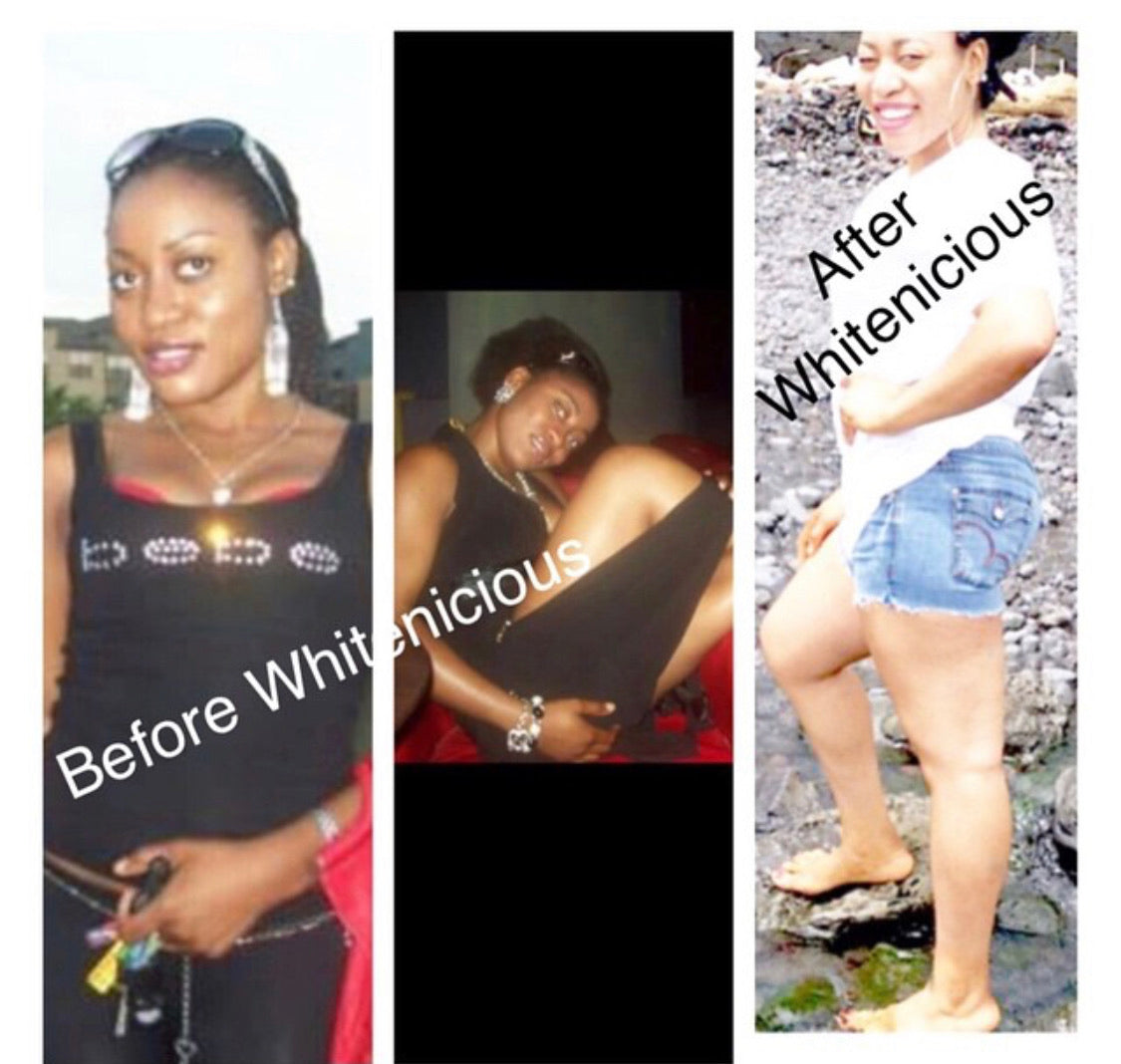 SNOW WHITE FULL BODY SET