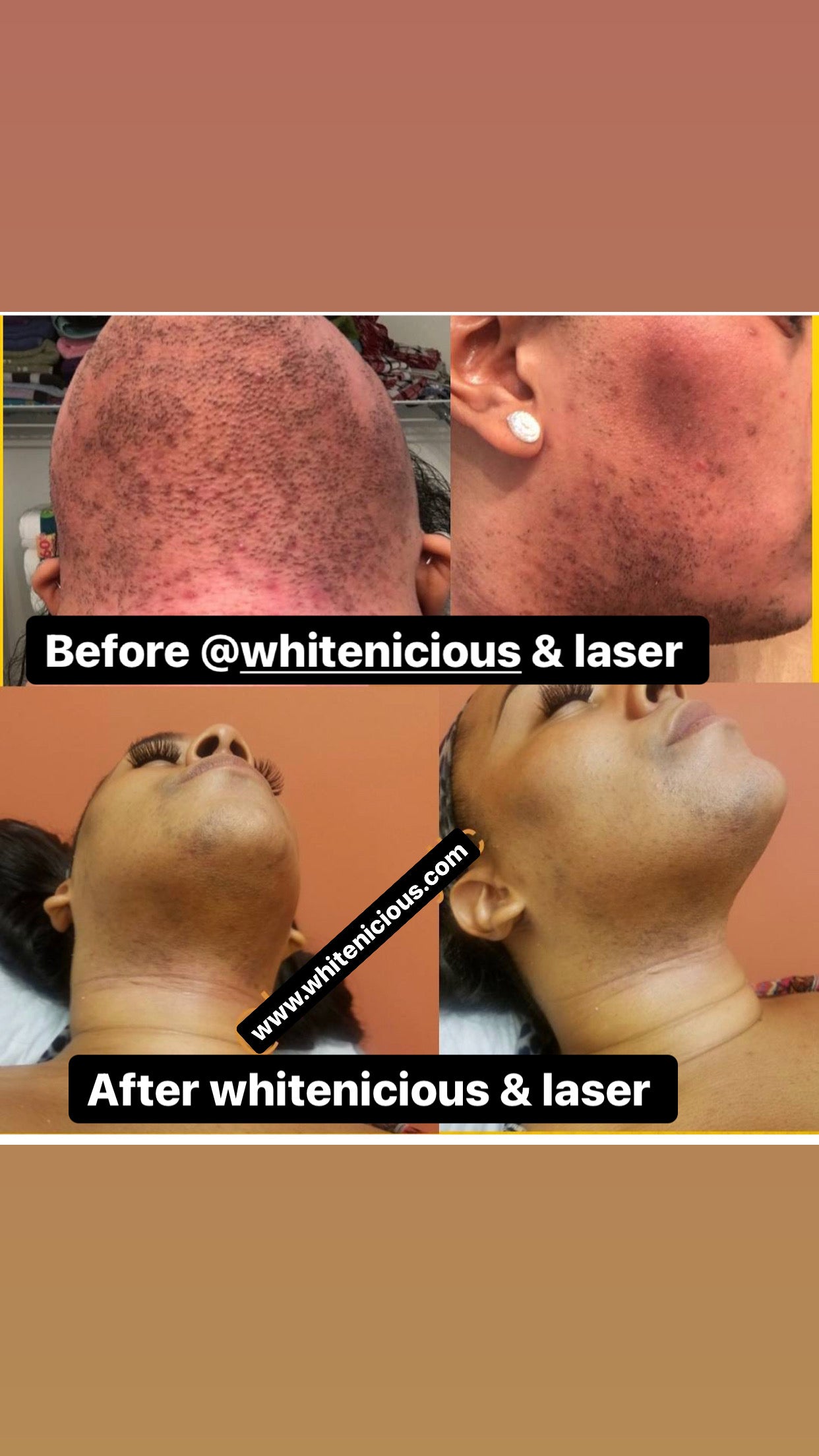 Face Brightening regimen system ( Oily Skin)
